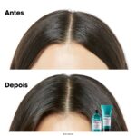 Serie Expert [Scalp Advanced] Shampoo anti-desconforto - Image 7